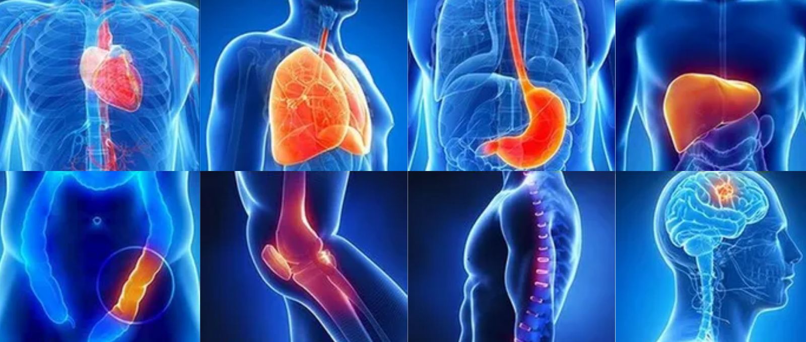 비침습 관련 게시글입니다.